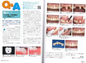 デンタルダイヤモンドに掲載されました