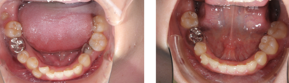 矯正治療の症例