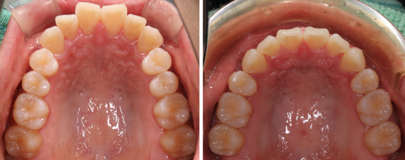 矯正治療の症例