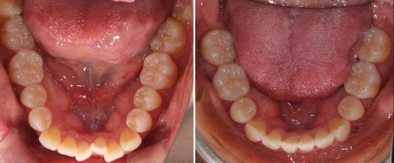 矯正治療の症例